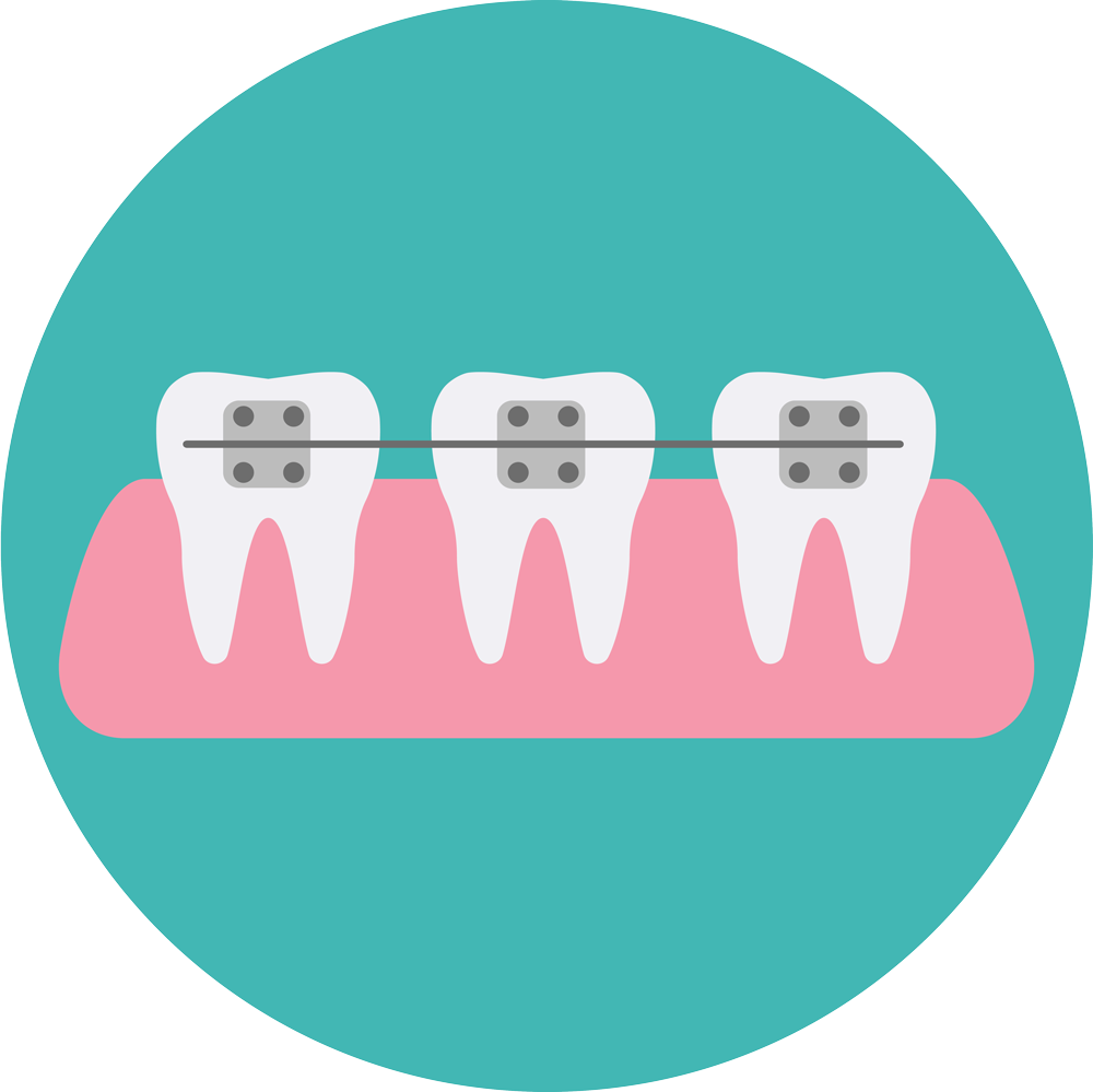 Брекеты зубов мультяшные иконки. Схема чистки зубов с брекетами. Фотопротокол ортодонта. Березка стоматология заря